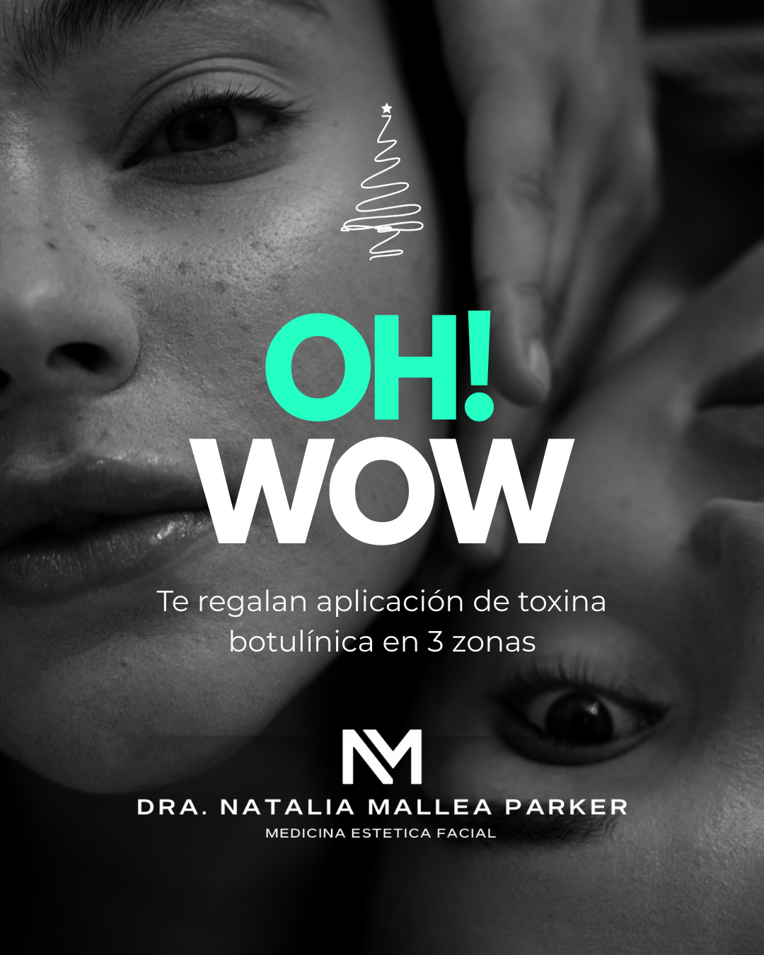 Gift Card Digital 3 zonas de toxina botulínica