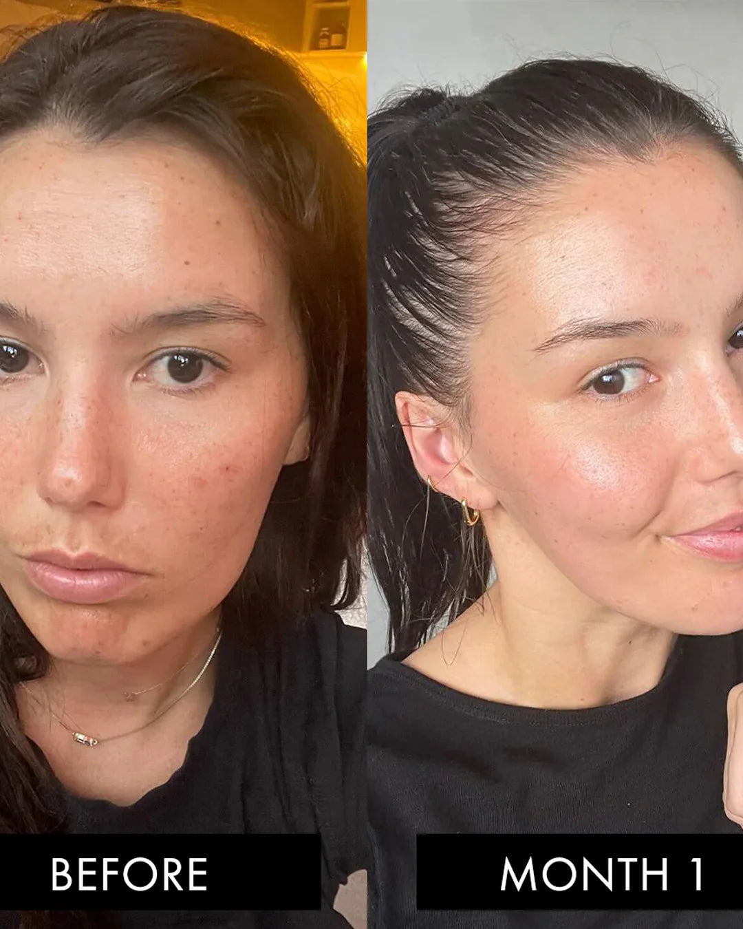 The Collagen Elixir